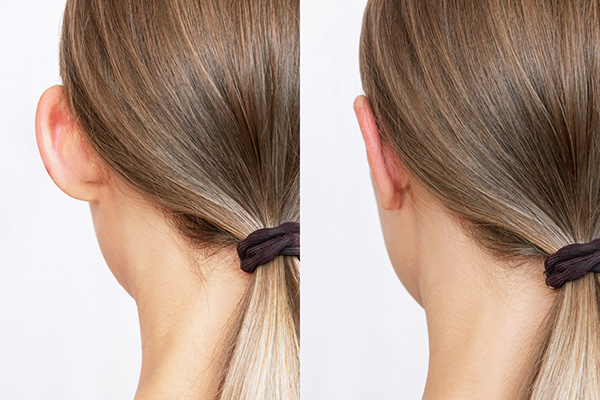 img-orejas-de-soplillo-bogota-2