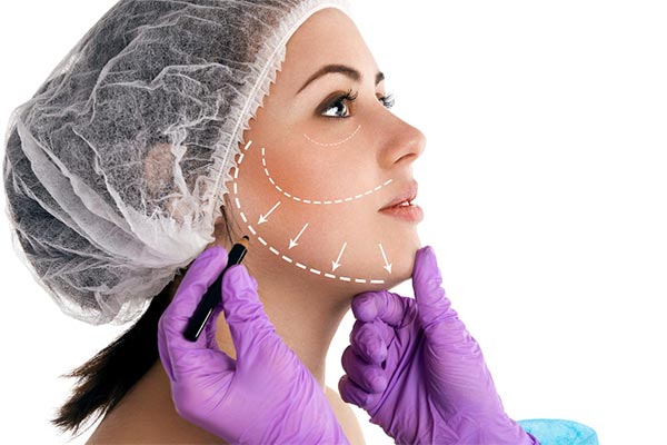 Resultados de cirugía para rejuvenecer la cara