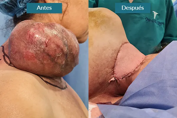 Img-CarlosCamachoCirujano-Antes&Después-ImgSensible-1