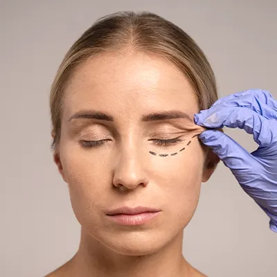 img-blepharoplasty-bogota-1-LCP