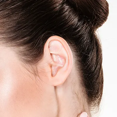 img-otoplastia-bogota-1-LCP