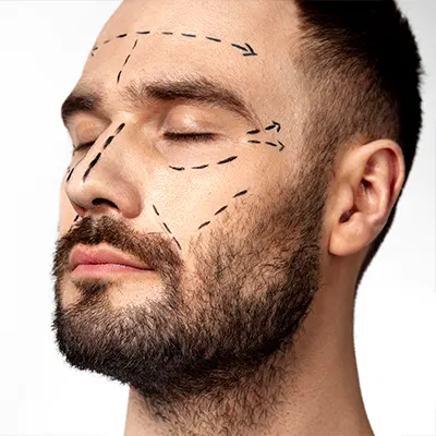 img-rhytidoplasty-bogota-1-LCP